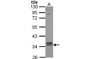 WB Image Sample (30 ug of whole cell lysate) A: Hep G2 , 10% SDS PAGE antibody diluted at 1:1000 (GPBAR1 Antikörper  (C-Term))