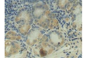 Immunohistochemistry (IHC) image for anti-Complement C2 (AA 245-451) antibody (ABIN7432784)