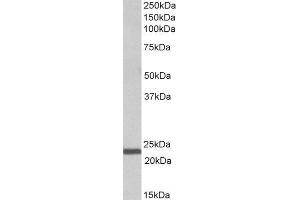 ABIN2563394 (1µg/ml) staining of Human Bone Marrow lysate (35µg protein in RIPA buffer). (IL-15 Antikörper  (AA 70-82))