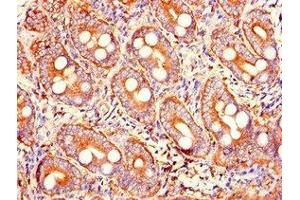 Immunohistochemistry of paraffin-embedded human small intestine tissue using ABIN7173598 at dilution of 1:100