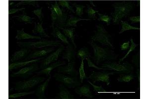 Immunofluorescence of monoclonal antibody to FTL on HeLa cell. (FTL Antikörper)