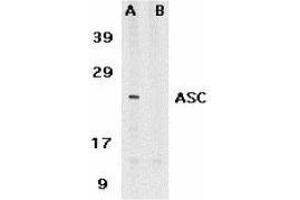 Western Blotting (WB) image for anti-PYD and CARD Domain Containing (PYCARD) (AA 182-195) antibody (ABIN2476855) (PYCARD Antikörper  (AA 182-195))