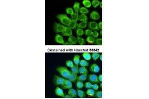ICC/IF Image Immunofluorescence analysis of methanol-fixed A431, using Complement C2, antibody at 1:200 dilution.