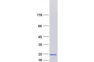 Western Blotting (WB) image for Trafficking Protein Particle Complex 6A (TRAPPC6A) protein (Myc-DYKDDDDK Tag) (ABIN2734190)