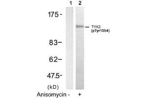 Western blot analysis of extracts from HT29 cells untreated(lane 1) or treated with Anisomycin(lane 2) using TYK2(Phospho-Tyr1054) Antibody. (TYK2 Antikörper  (pTyr1054))