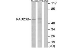 Western blot analysis of extracts from A549/HuvEc cells, using RAD23B Antibody. (RAD23B Antikörper  (AA 1-50))