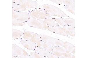Immunohistochemistry of paraffin embedded mouse Skeletal muscle using Troponin I (ABIN7076031) at dilution of 1:700 (400x lens) (TNNI2 Antikörper)