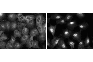 Immunofluorescent staining of A549 (ATCC CCL-185) cells. (NF-kB p65 Antikörper  (AA 136-224))
