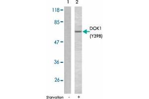 Western blot analysis of extracts from K-562 cells using DOK1 (phospho Y398) polyclonal antibody . (DOK1 Antikörper  (pTyr398))