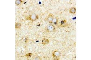 Immunohistochemical analysis of Transcobalamin-2 staining in mouse brain formalin fixed paraffin embedded tissue section. (TCN2 Antikörper)