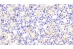 Detection of PCSK9 in Rat Kidney Tissue using Polyclonal Antibody to Proprotein Convertase Subtilisin/Kexin Type 9 (PCSK9) (PCSK9 Antikörper  (AA 164-428))