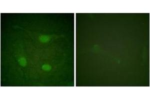 Immunofluorescence analysis of HeLa cells, using Elk3 (Phospho-Ser357) Antibody. (ELK3 Antikörper  (pSer357))