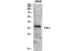 Western Blot (WB) analysis of specific cells using PAI-1 Polyclonal Antibody. (PAI1 Antikörper  (Internal Region))