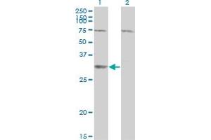 Western Blot analysis of SDR16C5 expression in transfected 293T cell line by RDHE2 monoclonal antibody (M01), clone 3G8. (SDR16C5 Antikörper  (AA 26-309))