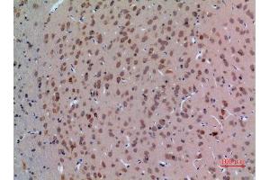 Immunohistochemistry (IHC) analysis of paraffin-embedded Rat Brain, antibody was diluted at 1:100. (Arginine Antikörper  (Internal Region))