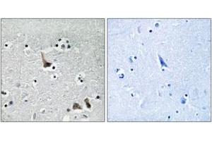 Immunohistochemistry (IHC) image for anti-ATPase, H+ Transporting, Lysosomal 50/57kDa, V1 Subunit H (ATP6V1H) (AA 341-390) antibody (ABIN2890686) (ATP6V1H Antikörper  (AA 341-390))