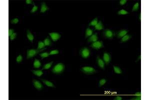 Immunofluorescence of monoclonal antibody to AKAP13 on HeLa cell. (AKAP13 Antikörper  (AA 1-110))