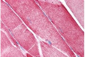 Human Skeletal Muscle (formalin-fixed, paraffin-embedded) stained with VDAC2 antibody ABIN213732 at 2. (VDAC2 Antikörper  (N-Term))