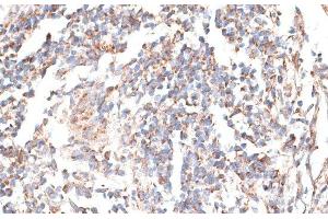 Immunohistochemistry of paraffin-embedded Human tonsil using KATNA1 Polyclonal Antibody at dilution of 1:100 (40x lens).