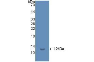 Detection of Recombinant Ub, Human using Polyclonal Antibody to Ubiquitin (Ub) (Ubiquitin Antikörper  (AA 1-229))