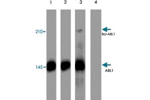 Western blot analysis of K-562 cells treated with pervanadate (1 mM) for 30 minutes (lanes 1 & 3). (ABL1 Antikörper  (pTyr245))