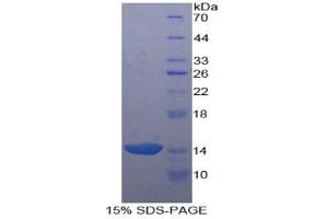 SDS-PAGE analysis of Human Agouti Related Protein. (AGRP Protein)