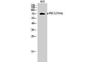 Western Blotting (WB) image for anti-Protein Kinase C, zeta (PRKCZ) (pThr410) antibody (ABIN3179493) (PKC zeta Antikörper  (pThr410))