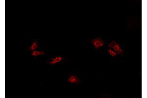 ABIN6269088 staining HeLa cells by IF/ICC. (ATP1A1 Antikörper  (N-Term))