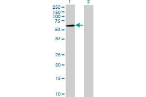 Western Blot analysis of IGHA2 expression in transfected 293T cell line by IGHA2 MaxPab polyclonal antibody. (IGHA2 Antikörper  (AA 1-477))