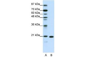 RPL9 antibody used at 1.