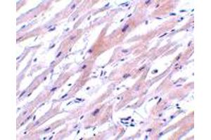 Immunohistochemistry of UNG in human heart tissue with UNG polyclonal antibody  at 2 ug/mL . (UNG Antikörper  (N-Term))