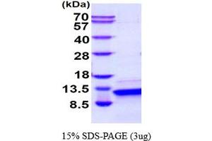 SDS-PAGE (SDS) image for Parathyroid Hormone (PTH) (AA 32-115) (Active) protein (ABIN6387772) (PTH Protein (AA 32-115))
