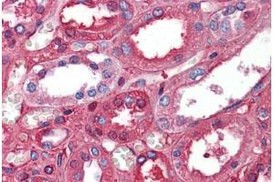 Immunohistochemistry (Formalin-fixed Paraffin-embedded Sections) (IHC (fp)) image for anti-Albumin (ALB) (AA 108-157) antibody (ABIN6747073)
