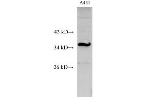 Western Blot analysis of A431 cell using C15orf23 Polyclonal Antibody at dilution of 1:500 (KNSTRN Antikörper)