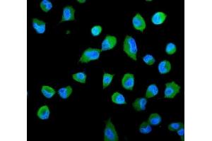 IF analysis of PSME2 using anti-PSME2 antibody (ABIN7599137).