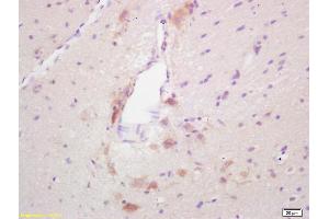 Formalin-fixed and paraffin embedded rat brain labeled with Rabbit Anti GAD65 Polyclonal Antibody, Unconjugated (ABIN668140) at 1:200 followed by conjugation to the secondary antibody and DAB staining (GAD65 Antikörper  (AA 501-585))