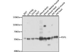 Western blot analysis of extracts of various cell lines, using PDP1 antibody (ABIN7269774) at 1:3000 dilution. (PDP Antikörper  (AA 72-260))