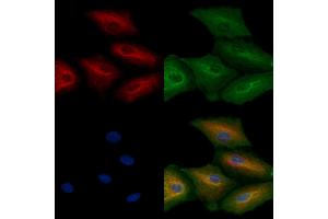ABIN6264551 and ABIN6272407 staining  cells by IF/ICC. (RAB11FIP4 Antikörper  (Internal Region))