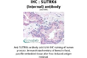 Image no. 2 for anti-SLIT and NTRK-Like Family, Member 6 (SLITRK6) (Internal Region) antibody (ABIN1739441) (SLITRK6 Antikörper  (Internal Region))