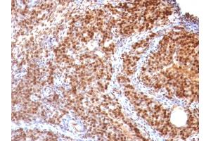 Formalin-fixed, paraffin-embedded Rat Ovary stained with SUMO-2 MAb (SUMO2/1199) (SUMO2 Antikörper)