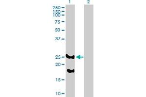 Western Blot analysis of REEP2 expression in transfected 293T cell line by REEP2 MaxPab polyclonal antibody. (REEP2 Antikörper  (AA 1-252))