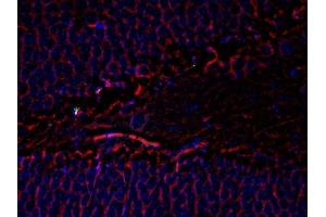 Immunofluorescence (IF) image for anti-Tubulin, beta 3 (TUBB3) antibody (ABIN371847) (TUBB3 Antikörper)