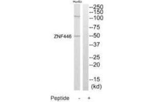 Western blot analysis of extracts from HuvEc cells, using ZNF446 antibody. (ZNF446 Antikörper)