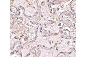 Immunohistochemical staining of human lung tissue using AP30389PU-N GSTP1 antibody at 2. (GSTP1 Antikörper  (Center))