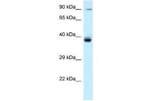 Western Blotting (WB) image for anti-T-Cell Activation rho GTPase-Activating Protein (TAGAP) (N-Term) antibody (ABIN926841)