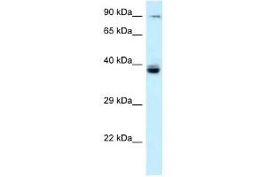 Western Blot showing TAGAP antibody used at a concentration of 1 ug/ml against Fetal Liver Lysate (TAGAP Antikörper  (N-Term))