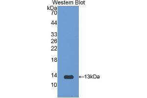 Western blot analysis of the recombinant protein. (IL1R1 Antikörper  (AA 119-217))