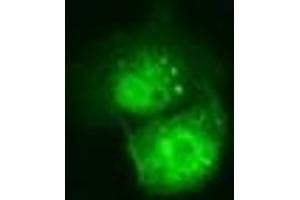 Anti-C21orf59 mouse monoclonal antibody (ABIN2452866) immunofluorescent staining of COS7 cells transiently transfected by pCMV6-ENTRY C21orf59 (RC200169). (C21orf59 Antikörper)