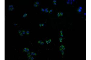 Immunofluorescence staining of Hela cells with ABIN7146439 at 1:100, counter-stained with DAPI. (CAMK2A Antikörper  (AA 321-478))