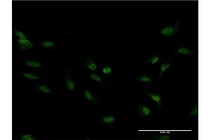 Immunofluorescence of monoclonal antibody to FOXM1 on HeLa cell. (FOXM1 Antikörper  (AA 22-110))